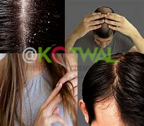Hair Problem